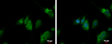 Anti-QTRT1 antibody used in Immunocytochemistry/ Immunofluorescence (ICC/IF). GTX118778