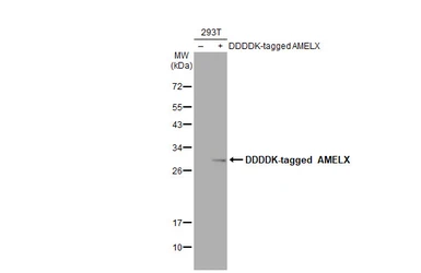 Anti-AMELX antibody used in Western Blot (WB). GTX118869