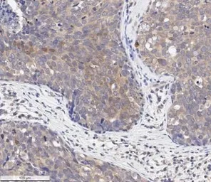 Anti-AKT (phospho Ser473) antibody [104A282] used in IHC (Paraffin sections) (IHC-P). GTX11901
