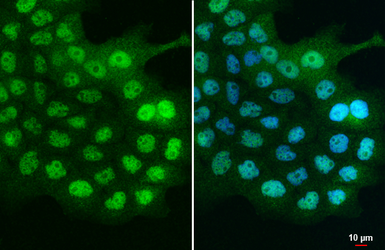 Anti-C21orf2 antibody [N1C2] used in Immunocytochemistry/ Immunofluorescence (ICC/IF). GTX119046