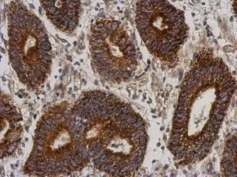 Anti-C21orf2 antibody [N1C2] used in IHC (Paraffin sections) (IHC-P). GTX119046