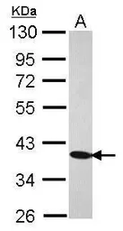Anti-C21orf2 antibody [N1C2] used in Western Blot (WB). GTX119046