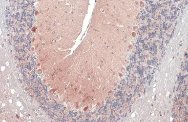 Anti-RAB11B antibody [N1C3] used in IHC (Paraffin sections) (IHC-P). GTX119095