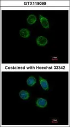 Anti-CHST2 antibody [N3C3] used in Immunocytochemistry/ Immunofluorescence (ICC/IF). GTX119099