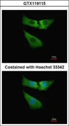 Anti-INMT antibody [N1C3] used in Immunocytochemistry/ Immunofluorescence (ICC/IF). GTX119115