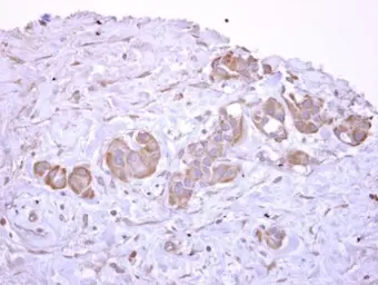 Anti-V-ATPase D antibody used in IHC (Paraffin sections) (IHC-P). GTX119155