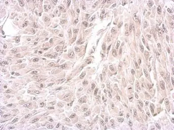 Anti-WDR19 antibody [N1N2], N-term used in IHC (Paraffin sections) (IHC-P). GTX119202