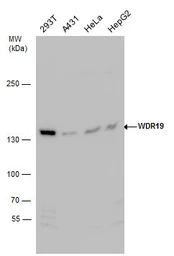 Anti-WDR19 antibody [N1N2], N-term used in Western Blot (WB). GTX119202
