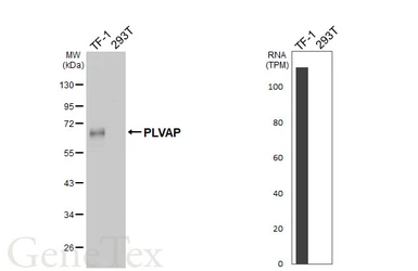 Anti-PLVAP antibody [N3C3] used in Western Blot (WB). GTX119233