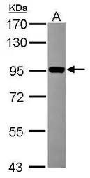 Anti-ZNF598 antibody [N1N3] used in Western Blot (WB). GTX119245