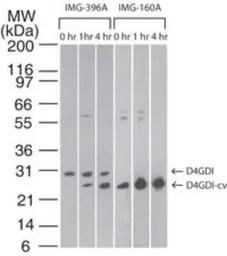 Anti-D4 GDI (cleaved specific) antibody [97A1015] used in Western Blot (WB). GTX11927