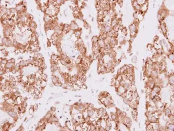 Anti-SDR16C5 antibody [N1C3] used in IHC (Paraffin sections) (IHC-P). GTX119280