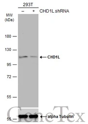 Anti-CHD1L antibody [N2C1], Internal used in Western Blot (WB). GTX119360