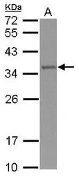 Anti-TRMT61A antibody [N1C2] used in Western Blot (WB). GTX119398