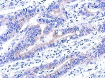 Anti-VPS33A antibody [C1C3] used in IHC (Paraffin sections) (IHC-P). GTX119416