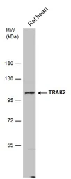 Anti-TRAK2 antibody [N1N2], N-term used in Western Blot (WB). GTX119423