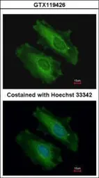 Anti-SNX18 antibody used in Immunocytochemistry/ Immunofluorescence (ICC/IF). GTX119426
