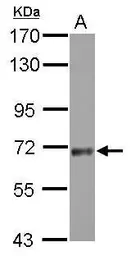 Anti-SNX18 antibody used in Western Blot (WB). GTX119426