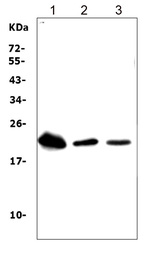 Anti-TREM1 antibody used in Western Blot (WB). GTX11944