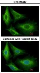 Anti-Glutathione S-transferase kappa 1 antibody [N1C2] used in Immunocytochemistry/ Immunofluorescence (ICC/IF). GTX119447