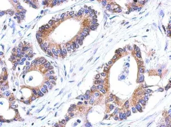 Anti-Glutathione S-transferase kappa 1 antibody [N1C2] used in IHC (Paraffin sections) (IHC-P). GTX119447