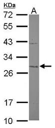Anti-MTIF3 antibody [N1C2] used in Western Blot (WB). GTX119582