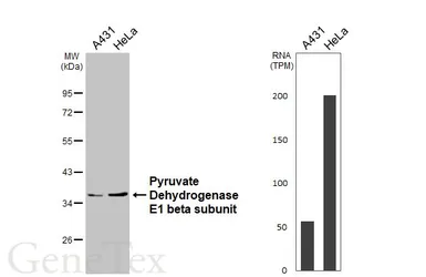 Anti-Pyruvate Dehydrogenase E1 beta subunit antibody used in Western Blot (WB). GTX119625
