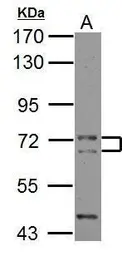 Anti-CALM antibody used in Western Blot (WB). GTX119631