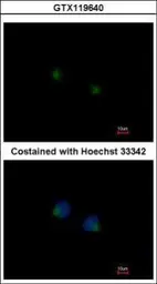 Anti-MGAT4A antibody [C1C3] used in Immunocytochemistry/ Immunofluorescence (ICC/IF). GTX119640