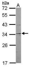 Anti-NRBF2 antibody [N2C3] used in Western Blot (WB). GTX119687