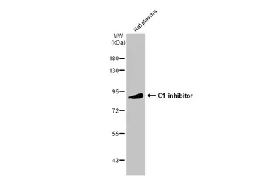 Anti-C1 inhibitor antibody [C1C3] used in Western Blot (WB). GTX119690