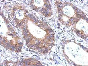 Anti-BTBD6 antibody [N2C2], Internal used in IHC (Paraffin sections) (IHC-P). GTX119712