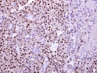 Anti-UBR7 antibody used in IHC (Paraffin sections) (IHC-P). GTX119742