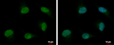 Anti-PSPC1 antibody used in Immunocytochemistry/ Immunofluorescence (ICC/IF). GTX119744