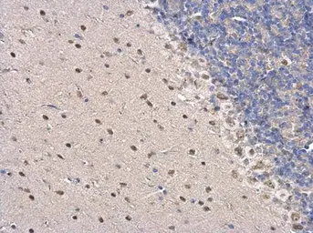 Anti-PSPC1 antibody used in IHC (Paraffin sections) (IHC-P). GTX119744