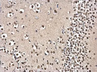 Anti-PSPC1 antibody used in IHC (Paraffin sections) (IHC-P). GTX119744