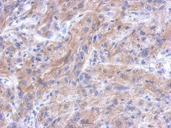 Anti-CTTNBP2NL antibody [N1N3] used in IHC (Paraffin sections) (IHC-P). GTX119828
