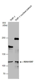 Anti-KIAA1267 antibody [N1N2], N-term used in Western Blot (WB). GTX120002