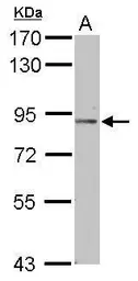 Anti-PODN antibody used in Western Blot (WB). GTX120026