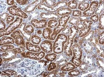 Anti-PABPC5 antibody used in IHC (Paraffin sections) (IHC-P). GTX120031