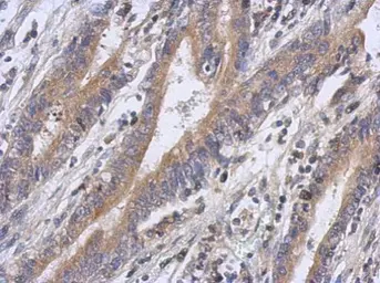 Anti-FBXW5 antibody [N2C2], Internal used in IHC (Paraffin sections) (IHC-P). GTX120049