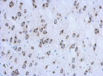 Anti-CKAP4 antibody [N3C3] used in IHC (Paraffin sections) (IHC-P). GTX120087