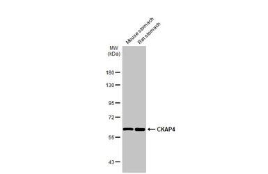 Anti-CKAP4 antibody [N3C3] used in Western Blot (WB). GTX120087