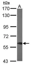 Anti-DYNC1LI1 antibody used in Western Blot (WB). GTX120114