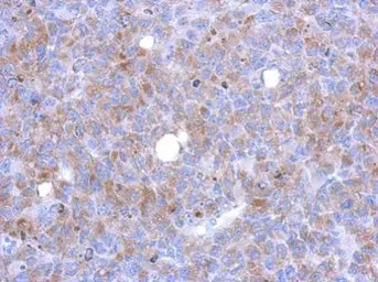 Anti-DDEFL1 antibody [N3C2], Internal used in IHC (Paraffin sections) (IHC-P). GTX120116