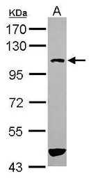 Anti-DDEFL1 antibody [N3C2], Internal used in Western Blot (WB). GTX120116