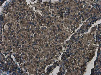 Anti-ZC3HAV1 antibody [N3C2], Internal used in IHC (Paraffin sections) (IHC-P). GTX120134