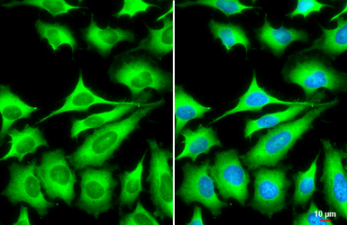Anti-ZC3HAV1 antibody [N3C2], Internal used in Immunocytochemistry/ Immunofluorescence (ICC/IF). GTX120134
