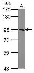 Anti-KIAA0323 antibody [C2C3], C-term used in Western Blot (WB). GTX120182