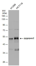 Anti-Pygopus 2 antibody used in Western Blot (WB). GTX120215